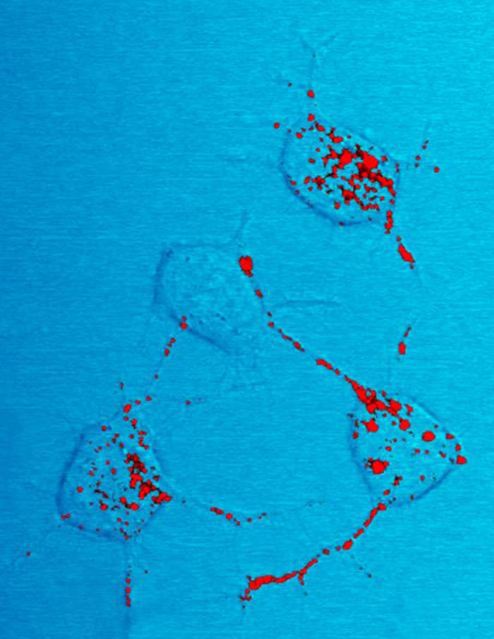 Scrapie prion protein visible stained in red in mouse neural tissue